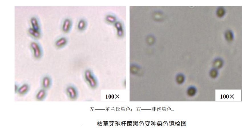 枯草芽孢桿菌黑色變種染色鏡檢